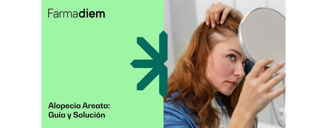 Alopecia areata: qu&eacute; es, causas y tratamientos