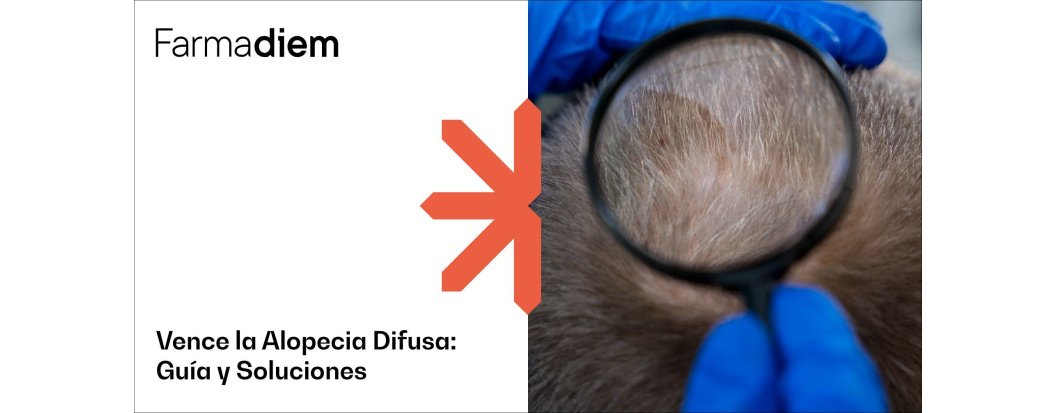¿Qué es la alopecia difusa y cómo tratarla?