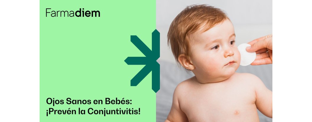 Conjuntivitis en beb&eacute;s: &iquest;C&oacute;mo actuar y prevenirla?