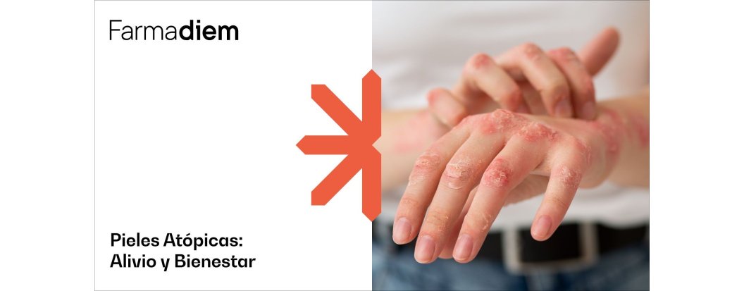 Pieles at&oacute;picas