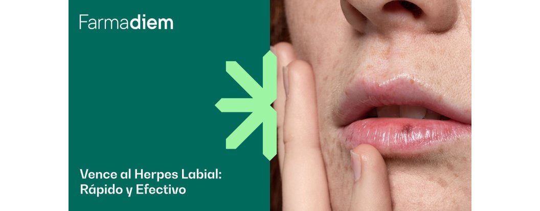 Herpes labial: causas, contagio y tratamiento