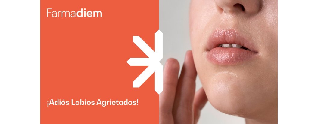 Labios agrietados: c&oacute;mo mejorar su aspecto