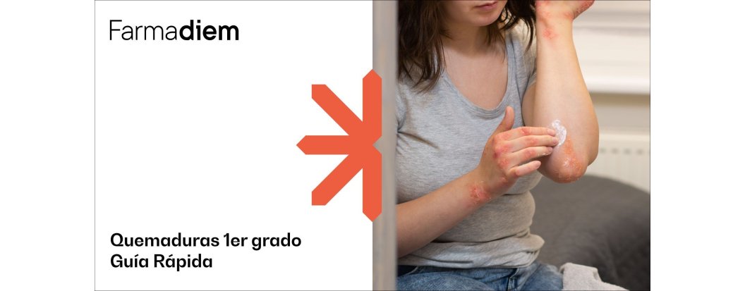 Quemaduras de primer grado: ¿cómo actuar?